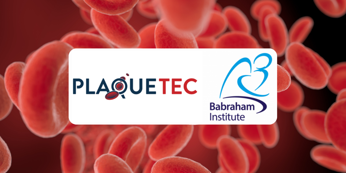 PlaqueTec and the ̨swag ̨swag collaborate on blood screen to improve treatment for coronary artery disease